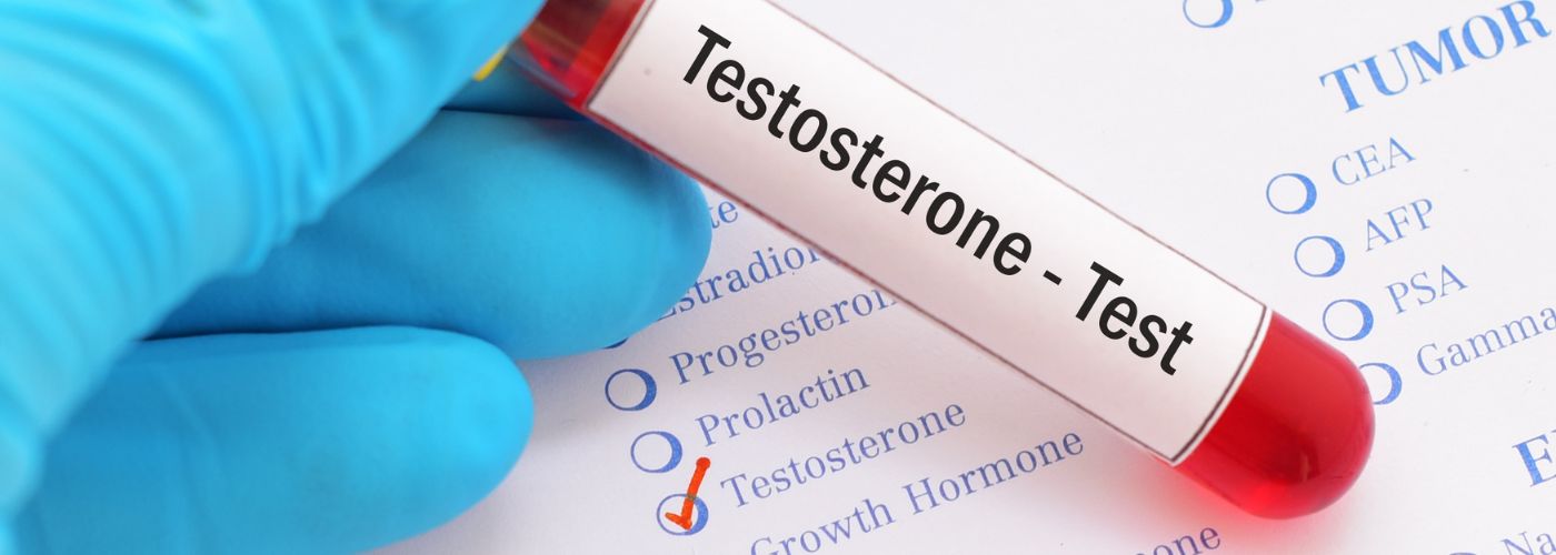 Does Kisspeptin Increase Testosterone